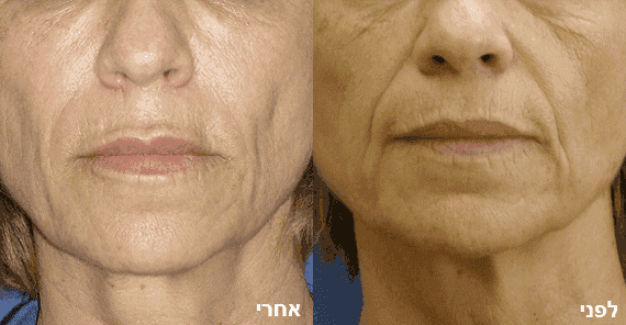 טיפולים אסתטיים